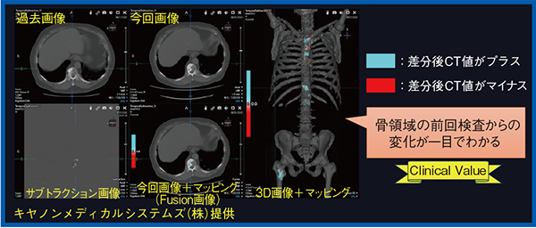 図1　TSBの解析結果の画面例