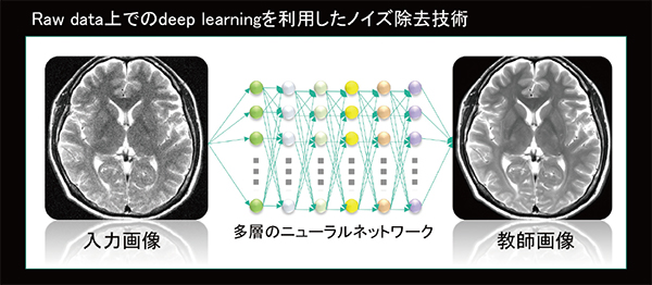 図3　DLRの概念