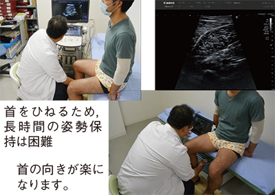 図15　Viamo sv7の下肢静脈エコーへの活用