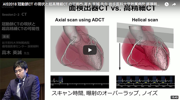 冠動脈CTの現状と超高精細CTの可能性 高木　英誠（岩手医科大学附属病院循環器医療センター 放射線科）