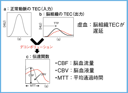 図1　CT perfusionのデコンボリューション（逆畳み込み）解析1）