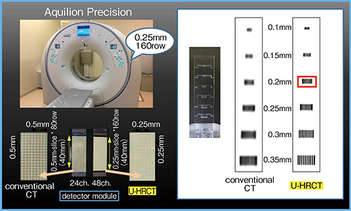 図1　Aquilion Precisionの特長