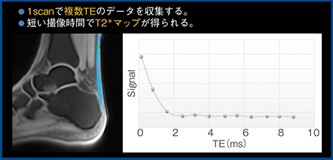 図6　UTE Multi EchoによるT2＊マップおよびプロット図（W.I.P.）