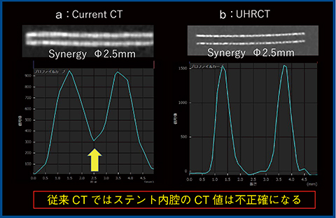 図2　従来CT（a）とAquilion Precision（b）のステント描出能の比較