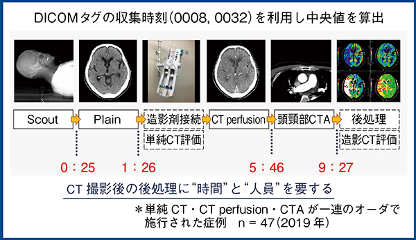 図2　CT検査に要する時間