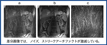 図1　UTE Time-SLIP with dDLR a：dDLRなし　b：dDLRあり　c：差分画像