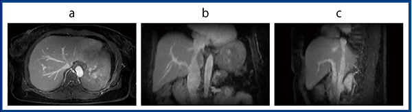 図5　t-Multi CNNによるdynamic MRI：3方向断面 a：axial　b：coronal　c：sagittal