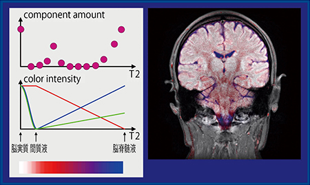 図2　T2によって色彩強度を変えたカラーマップ