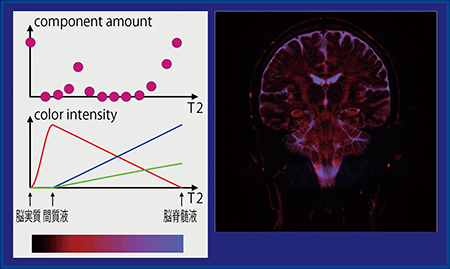 図4　脳脊髄液に注目したカラーマップ