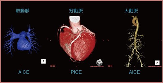 図4　Triple rule out適応症例（50歳代，90kg）のVR画像