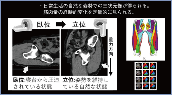 図3　当院にて開発中のAIソフトウエアを用いた筋肉量計測