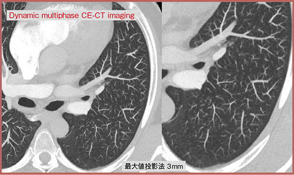 図3　高精細CTによる造影画像