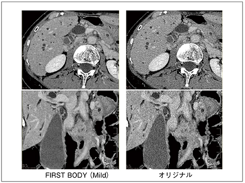 図3　FIRST画像とオリジナル画像比較（0.25mm厚，1024マトリックス）