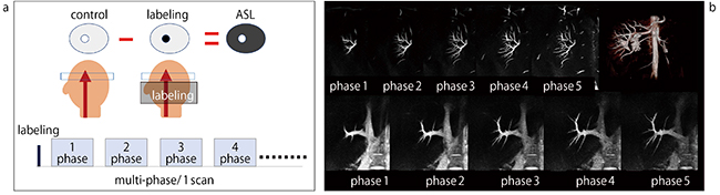 図1　mASTAR法のデータ取得方法（a）と腎動脈と門脈の画像例（b）