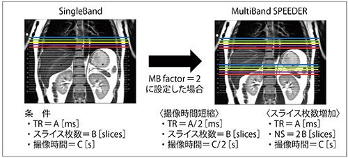 図4　MultiBand SPEEDER 撮像時間の短縮や撮像スライス枚数を増やすことができる。