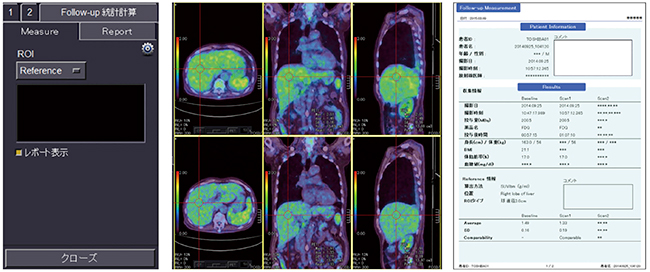 図6　Follow up measurementで用いる画面