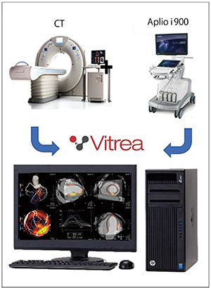 図2　Vitrea ワークステーション