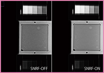 図1　ACR156ファントムの投影像へのSNRF有無の差