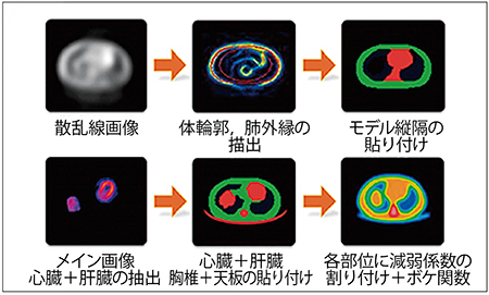 図5　SSPAC法による減弱マップ作成