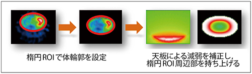 図6　SSPAC法の体輪郭補正機能