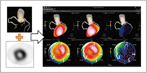 図8　NM Cardiac Fusion使用画像 （画像ご提供：鹿児島大学様）