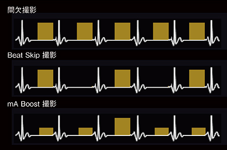 図6　ダイナミックボリューム撮影の種類