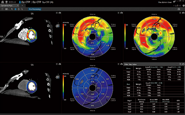 図7　ダイナミック心筋パーフュージョン解析結果画面