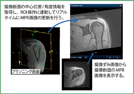 図1　ForeSee View概要