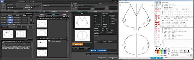 図2　マンモグラフィレポート画面