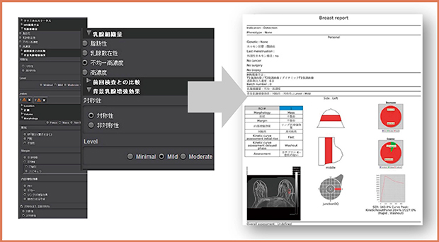 図5　BI-RADS第5版に準拠したレポート 読影結果を項目別に選択するだけでレポートの作成が可能