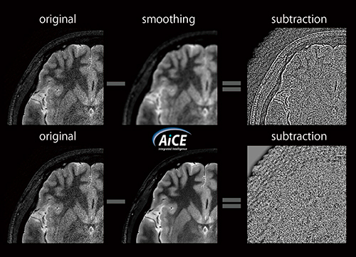 図4　AiCEのデノイズ特性