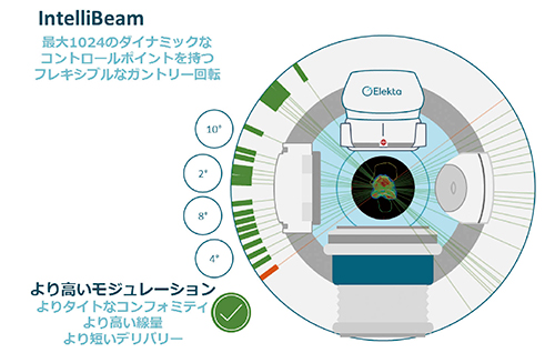 図1　IntelliBeamのコントロールポイント例