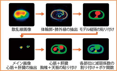 図5　SSPAC法による減弱マップ作成