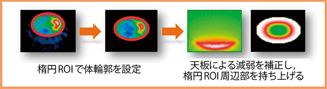 図6　SSPAC法の体輪郭補正機能