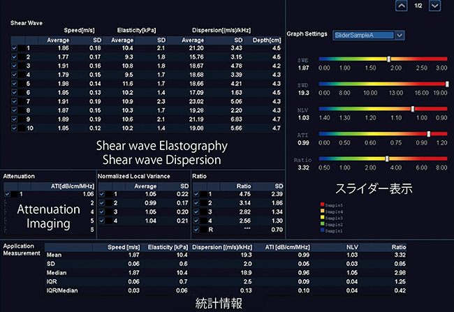 図2　Multi Parametric Report表示例＊ 一括モードで測定されたSWEとATIなどの指標値を一覧表示することができる。 また，施設ごとにカスタマイズ可能なスライダー表示も可能。