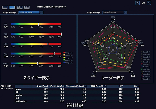 図3　Multi Parametric Reportトレンドグラフ表示例＊ スライダー表示（左）とレーダー表示（右）の2種類を作成・表示可能