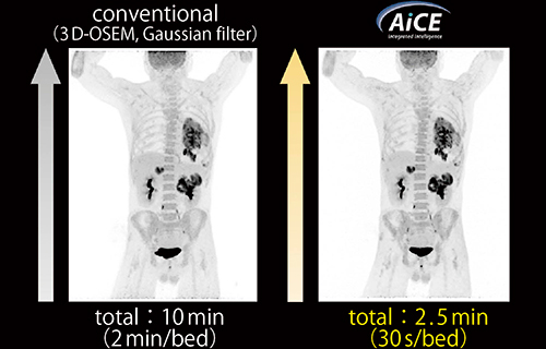図3　同一被検者でのGaussian filter画像とAiCE-i短時間PET画像との比較