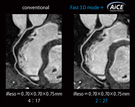 図2　従来法とFast 3D mode＋AiCEの適用例の比較