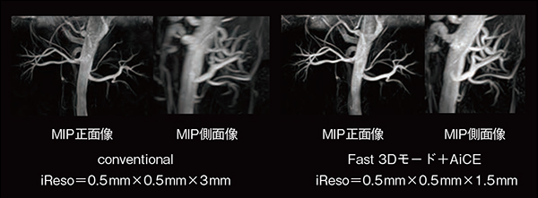 図2　Fast 3Dモードによる高分解能撮像