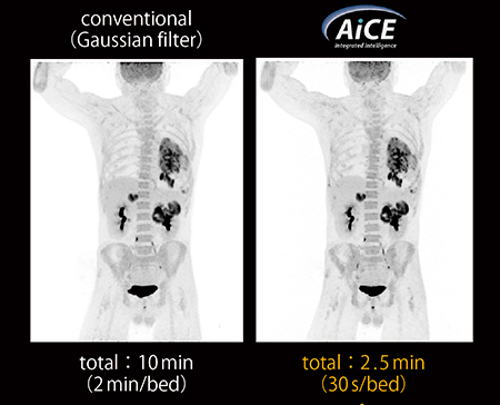 図1　同一被検者でのGaussian filter画像とAiCE-i短時間PET画像との比較