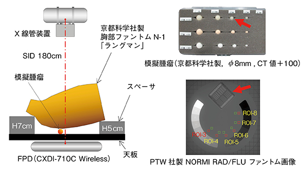 図1　模擬腫瘤の撮影配置とNORMI RAD/FLUファントム画像