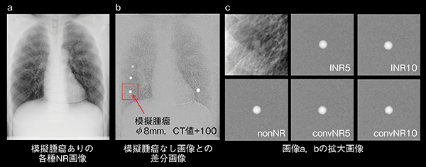 図6　模擬腫瘤画像抽出の概念図