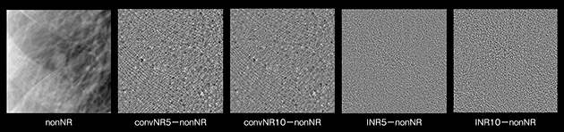 図7　各NR処理によって除去されたノイズ成分