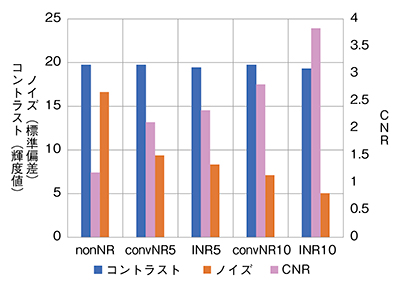 図9　X線量50%での各処理によるROI-3のCNR＜120kV＞