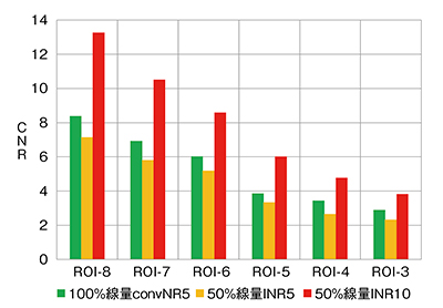 図10　X線量100％のconvNR5に対するX線量50％の INR5,10 のCNR＜120kV＞