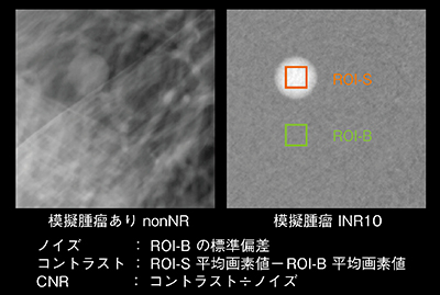 図11　模擬腫瘤のCNR解析画像（例：INR10）