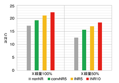 図12　X線量100%，50%での模擬腫瘤（φ8mm，CT値＋100）のCNR＜120kV＞