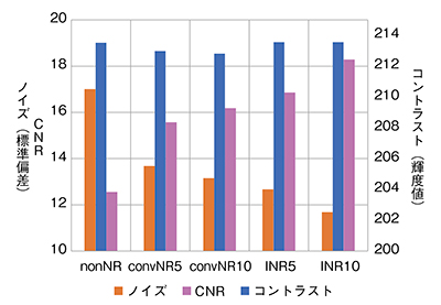 図13　X線量50%での模擬腫瘤（φ8mm，CT値＋100）のCNR＜120kV＞