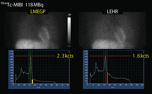 図1　LMEGPコリメータとLEHRコリメータの比較 （画像ご提供：国立循環器病研究センター様）