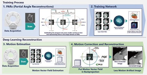 図3 CLEAR Motion Cardiacのアルゴリズム概要図 (上段:トレーニングプロセス,下段:再構成プロセス) 図3 CLEAR Motion Cardiacのアルゴリズム概要図 (上段:トレーニングプロセス,下段:再構成プロセス)